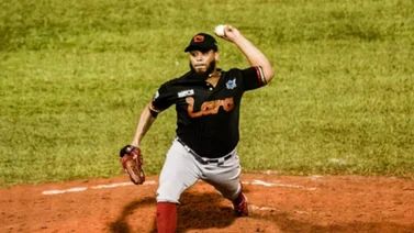 LVBP: ¡Duro golpe! Darwinson Hernández no volverá al nido del Cardenales de Lara (+Video)