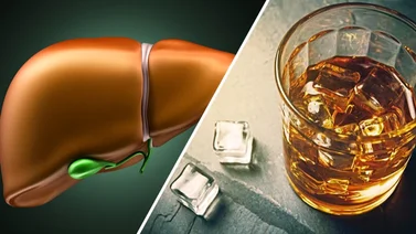 Estas son las mejorías que ocurren en tu hígado al eliminar el consumo de alcohol (+Video) 