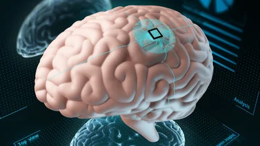¡La era de la transformación cibernética llegó! Implantan chip cerebral a un ser humano