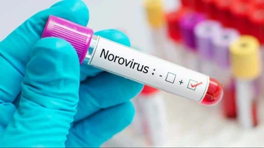  Norovirus en Estados Unidos