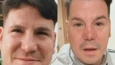 Cantante de "Andy y Lucas" es criticado en redes sociales por mala operación Cantante de "Andy y Lucas" es criticado en redes sociales por mala operación