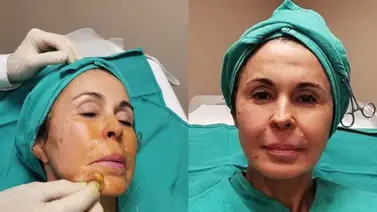 María Conchita Alonso cuenta por qué entró a quirófano (+Detalles) María Conchita Alonso cuenta por qué entró a quirófano (+Detalles)