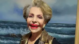 Estelita del Llano sufre grave fractura y requiere ayuda económica 