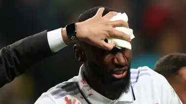 Antonio Rudiger cae lesionado para el Real Madrid (+Video) Antonio Rudiger cae lesionado para el Real Madrid (+Video)