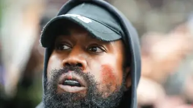 La difícil condición que sufre Kanye West La difícil condición que sufre Kanye West