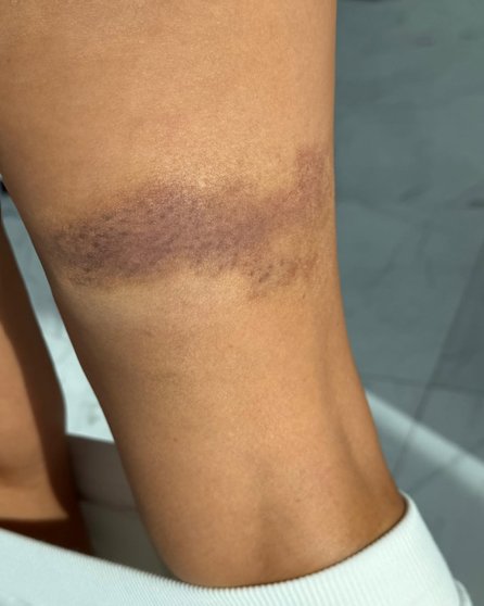 Thalía sufre accidente en Premio Lo Nuestro ¿Qué pasó?- Thalía sufre accidente en Premio Lo Nuestro ¿Qué pasó?