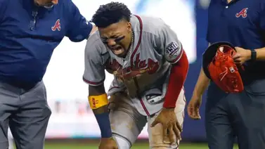 MLB: ¿Para preocuparse? Brian Snitker da detalles sobre la molestia física de Ronald Acuña Jr. MLB: ¿Para preocuparse? Brian Snitker da detalles sobre la molestia física de Ronald Acuña Jr.