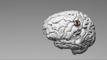 ¡No es Neuralink! Esta es la primera empresa que logró hacer implantes cerebrales