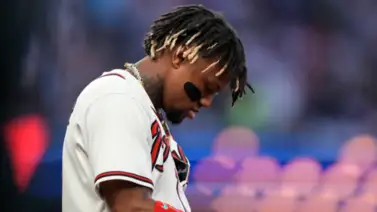 MLB: ¿Puede Ronald Acuña Jr. perderse la temporada 2024 por su lesión? MLB: ¿Puede Ronald Acuña Jr. perderse la temporada 2024 por su lesión?