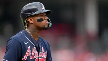 MLB: ¿Cuántas lesiones ha sufrido Ronald Acuña Jr. en su carrera? (+Video) MLB: ¿Cuántas lesiones ha sufrido Ronald Acuña Jr. en su carrera? (+Video)