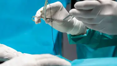 Este es el porcentaje de hombres que se practican la vasectomía en el país Este es el porcentaje de hombres que se practican la vasectomía en el país