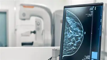 Mamografías gratuitas en Dallas: Fechas y requisitos para acceder al servicio Mamografías gratuitas en Dallas: Fechas y requisitos para acceder al servicio