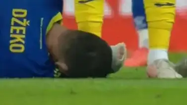 Así quedó la cara de Edin Dzeko tras dura entrada contra Rumania (+ Foto) Así quedó la cara de Edin Dzeko tras dura entrada contra Rumania (+ Foto)