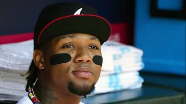 MLB: Ronald Acuña Jr. es enviado a la lista de lesionados