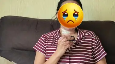 Actriz mexicana casi muere quemada tras problemas de gas en su casa Actriz mexicana casi muere quemada tras problemas de gas en su casa