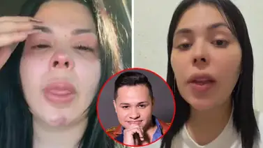 Vocalista de Los Recoditos golpeó y acuchilló a su esposa frente a sus hijos Vocalista de Los Recoditos golpeó y acuchilló a su esposa frente a sus hijos