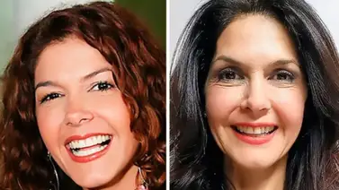 Crisol Carabal se sometió a doloroso proceso estético y así luce Crisol Carabal se sometió a doloroso proceso estético y así luce