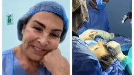 A sus 64 años, Alba Roversi se sometió a una cirugía estética para rejuvenecer 