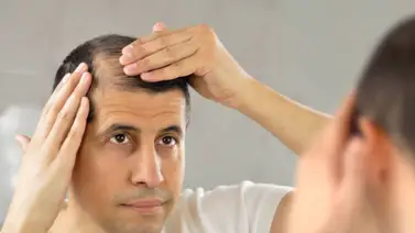 ¿Cómo evitar la caída del cabello? Lo que debes saber ¿Cómo evitar la caída del cabello? Lo que debes saber