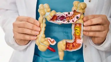 ¿Cuál es la función del apéndice y por qué su inflamación puede ser muy grave? ¿Cuál es la función del apéndice y por qué su inflamación puede ser muy grave?