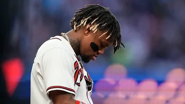 MLB: Mira algunas de las razones del lento arranque de Ronald Acuña Jr. (+Video)