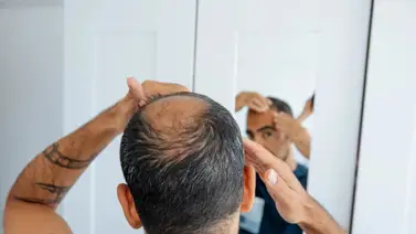 Secretos revelados: ¿Cómo hacer crecer el cabello de forma efectiva? Secretos revelados: ¿Cómo hacer crecer el cabello de forma efectiva?
