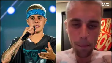 Aspecto físico de Justin Bieber preocupa a sus fans (+Video) Aspecto físico de Justin Bieber preocupa a sus fans (+Video)