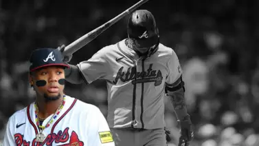 MLB: ¿Extrañan a Ronald Acuña Jr.? Atlanta sufre desastrosa marca en este inicio de temporada MLB: ¿Extrañan a Ronald Acuña Jr.? Atlanta sufre desastrosa marca en este inicio de temporada