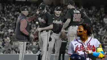 MLB: ¿Ausencia de Ronald Acuña Jr. pone en crisis a Bravos de Atlanta en 2025? MLB: ¿Ausencia de Ronald Acuña Jr. pone en crisis a Bravos de Atlanta en 2025?