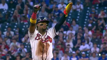 MLB: ¡Sonríe Atlanta! Ronald Acuña muestra progresos en su proceso rehabilitación MLB: ¡Sonríe Atlanta! Ronald Acuña muestra progresos en su proceso rehabilitación
