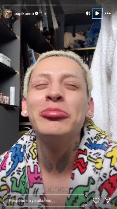 Golpean a Kunno: Influencer denuncia ataque homofóbico - Golpean a Kunno: Influencer denuncia ataque homofóbico