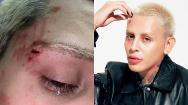Golpean a Kunno: Influencer denuncia ataque homofóbico 