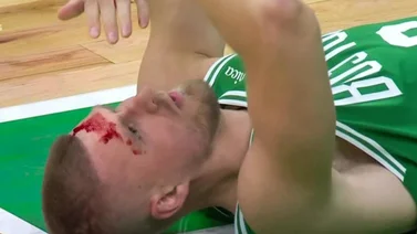 NBA: ¿Podrá seguir jugando? Kristaps Porzingis sufre grave golpe en su rostro en el duelo ante Orlando Magic