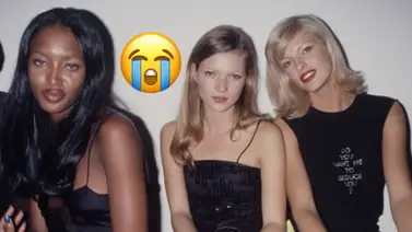 Emblemática supermodelo quedó desfigurada por un tratamiento estético Emblemática supermodelo quedó desfigurada por un tratamiento estético