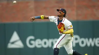 MLB: El regreso de Ronald Acuña Jr. sigue siendo una incógnita para Atlanta MLB: El regreso de Ronald Acuña Jr. sigue siendo una incógnita para Atlanta