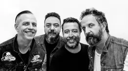 Integrante de Molotov se somete a cirugía reconstructiva producto de sus adicciones