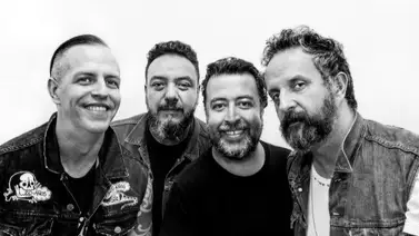 Integrante de Molotov se somete a cirugía reconstructiva producto de sus adicciones Integrante de Molotov se somete a cirugía reconstructiva producto de sus adicciones