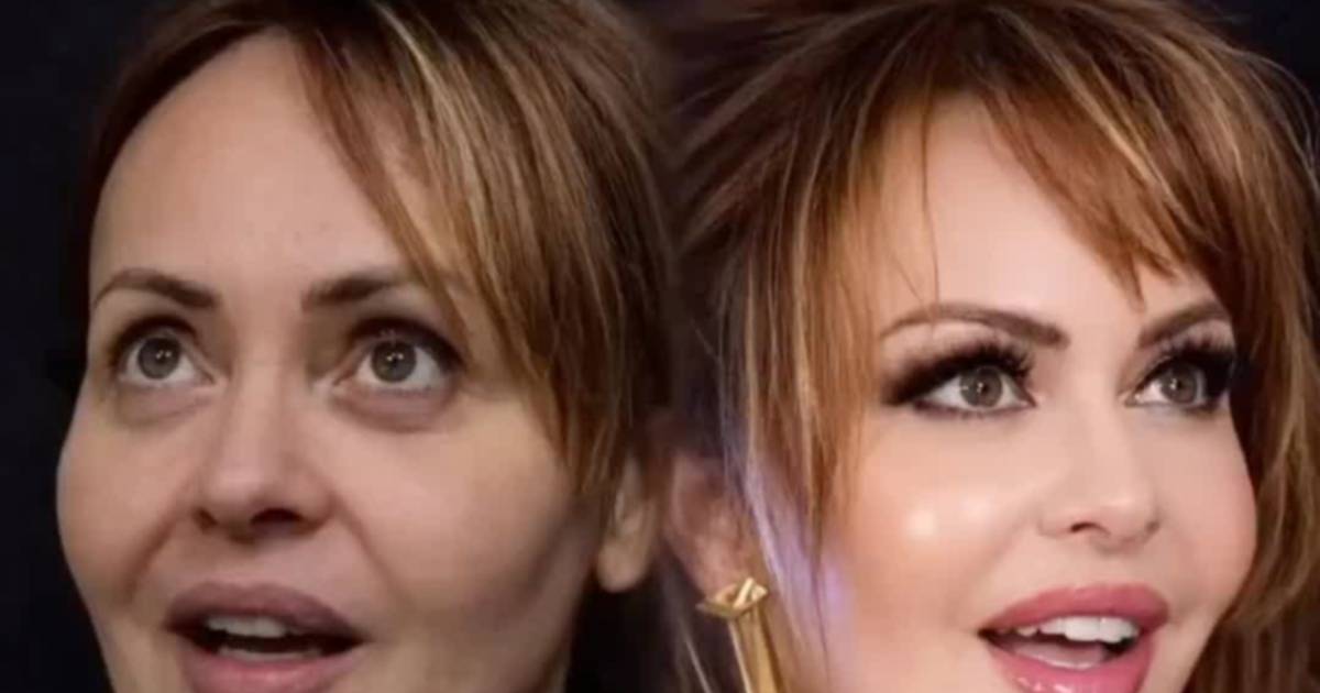Gaby Spanic Reveals New Look After Dramatic Facial Surgery - News Directory 3
