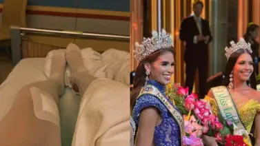Exreina de belleza venezolana fue operada de delicada enfermedad: "Dolor constante" Exreina de belleza venezolana fue operada de delicada enfermedad: "Dolor constante"