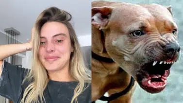 La razón de peso por la cual Lele Pons fue atacada salvajemente por un Pitbull La razón de peso por la cual Lele Pons fue atacada salvajemente por un Pitbull