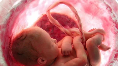 ¿Cómo es la placenta y cuál es su función durante el embarazo?