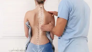 ¿Cómo se puede corregir la escoliosis en adultos? ¿Cómo se puede corregir la escoliosis en adultos?