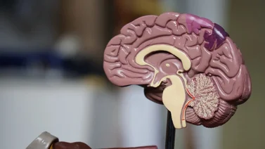 Derrame Cerebral: Medidas que debes considerar para evitar uno