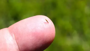 ¿Cómo sacar una espina del dedo de forma correcta? Cigna tiene la respuesta ¿Cómo sacar una espina del dedo de forma correcta? Cigna tiene la respuesta