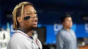 Ronald Acuña Jr. se pierde el resto de la temporada 2024 (+Video) Ronald Acuña Jr. se pierde el resto de la temporada 2024 (+Video)