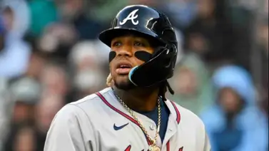 MLB: ¿Cómo se provoca y se repara la rotura de ligamento cruzado anterior? (+Video) MLB: ¿Cómo se provoca y se repara la rotura de ligamento cruzado anterior? (+Video)