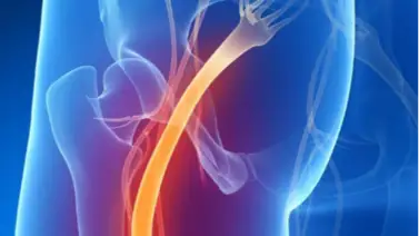 ¿Te duele el nervio ciático? Con estos ejercicios en casa puedes aliviar el dolor ¿Te duele el nervio ciático? Con estos ejercicios en casa puedes aliviar el dolor