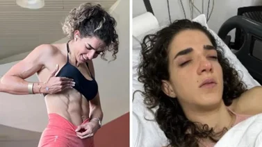 Experto reveló por qué la influencer JouFit tuvo que ir a emergencias luego de aplicarse bótox
