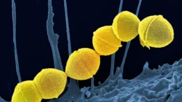 Alerta sanitaria en EEUU: Creciente proliferación de infecciones por Streptococcus pyogenes