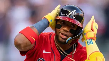 MLB: ¡Ay! Ronald Acuña Jr. sale del juego tras presentar una molestia en la pierna MLB: ¡Ay! Ronald Acuña Jr. sale del juego tras presentar una molestia en la pierna